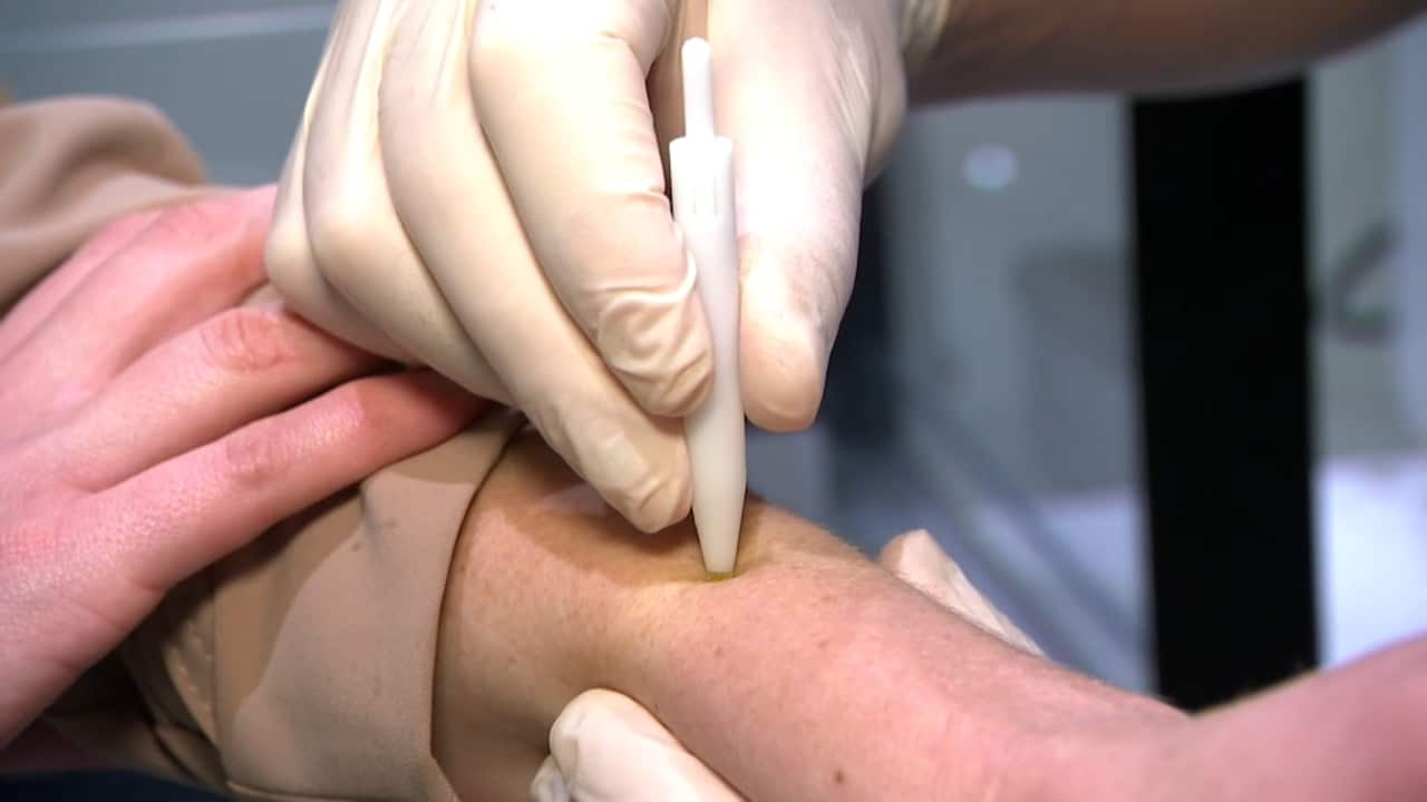 A medical practioner wearing gloves is performing a skin patch test on a patient.